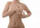 Proč se pod prsy objevuje plenková vyrážka a jak s nimi zacházet