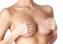 Odrůdy plastické chirurgie prsu: tvarová korekce, implantace