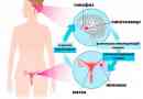Estrogenové a progesteronové receptory u rakoviny prsu