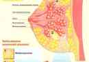 Nemoci žlázové tkáně prsu